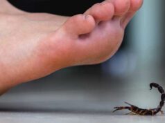 शाहजहां काल में एक लेखक ने इस तरह ईजाद किया बिच्छू काटने की दवा