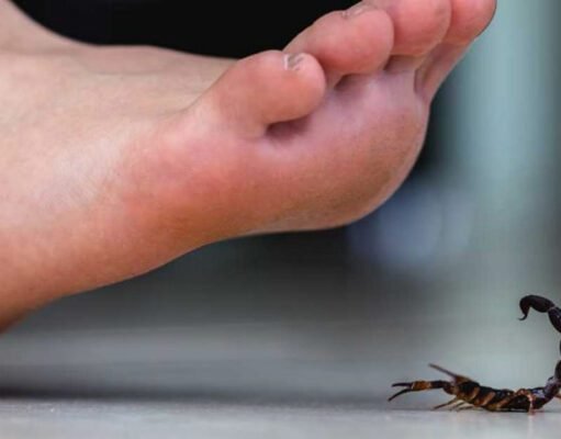 शाहजहां काल में एक लेखक ने इस तरह ईजाद किया बिच्छू काटने की दवा