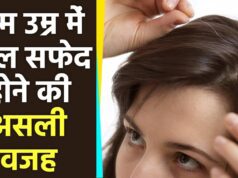 कम उम्र में बाल सफेद होने के कारण और उपाय